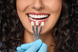 porcelain veneers in red deer
