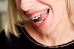 orthodontics in peterborough