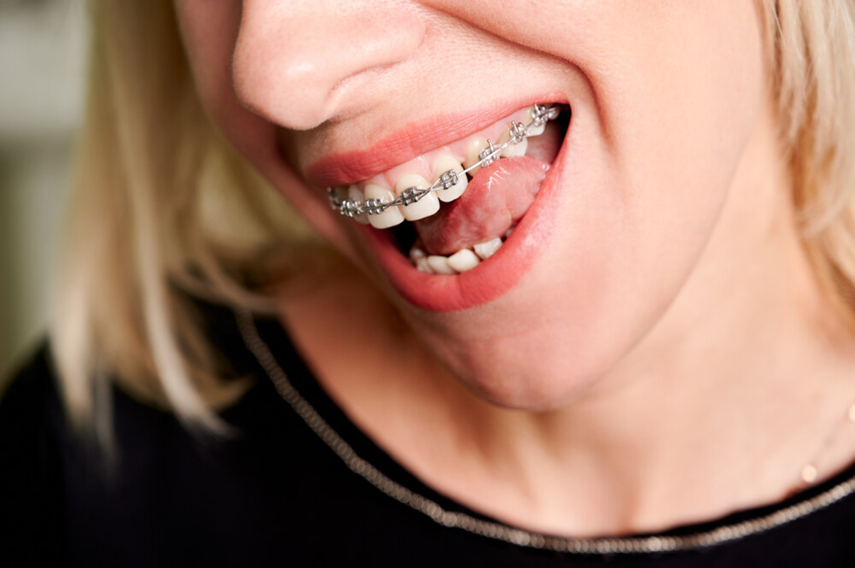 orthodontics in peterborough