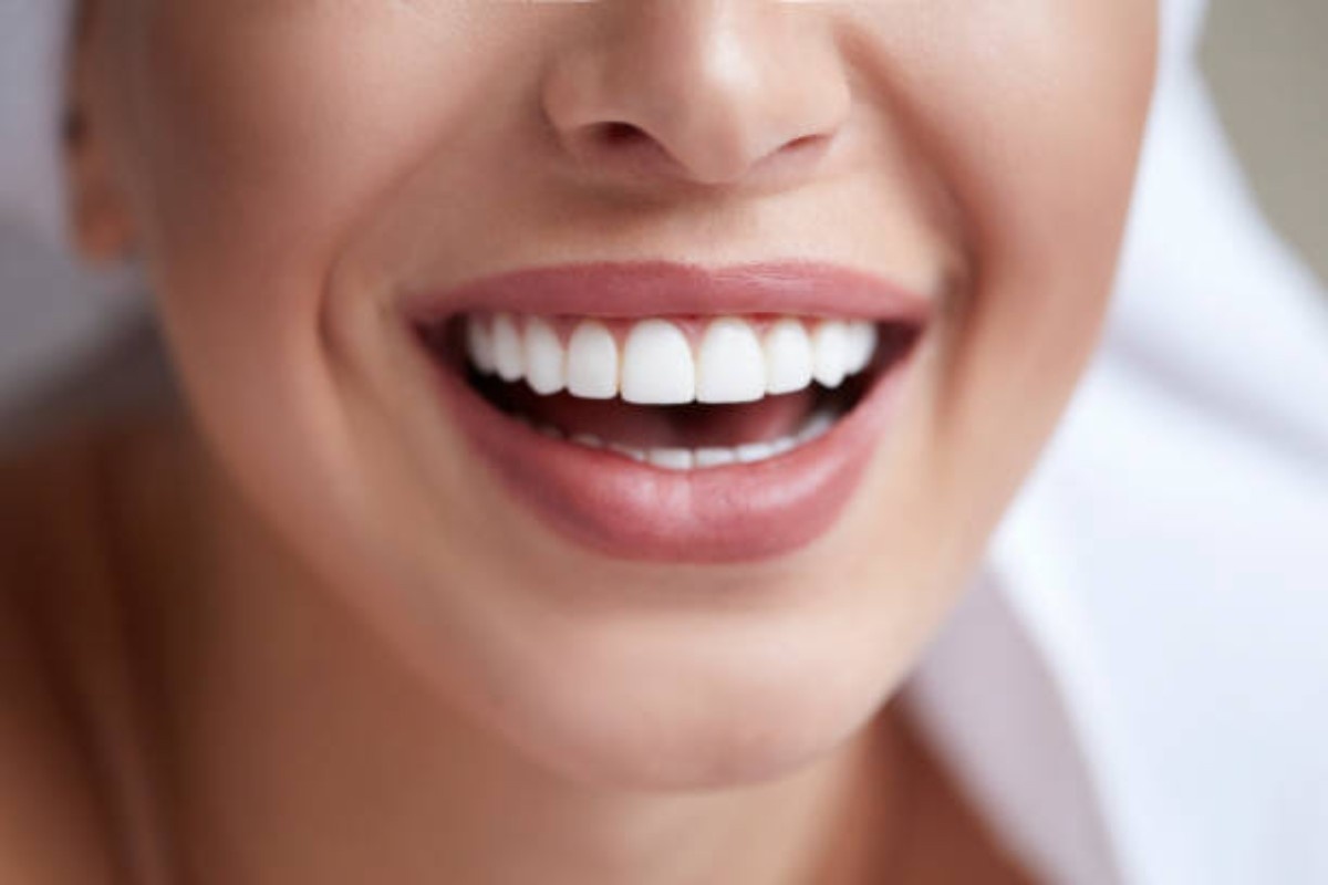 how teeth whitening works