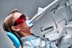 tips to avoid bad whitening results