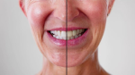 cosmetic dentistry in peterborough