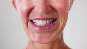 cosmetic dentistry in peterborough