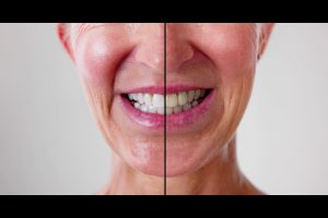 Cosmetic dental treatments including teeth whitening, veneers, and smile makeover for a brighter, confident smile