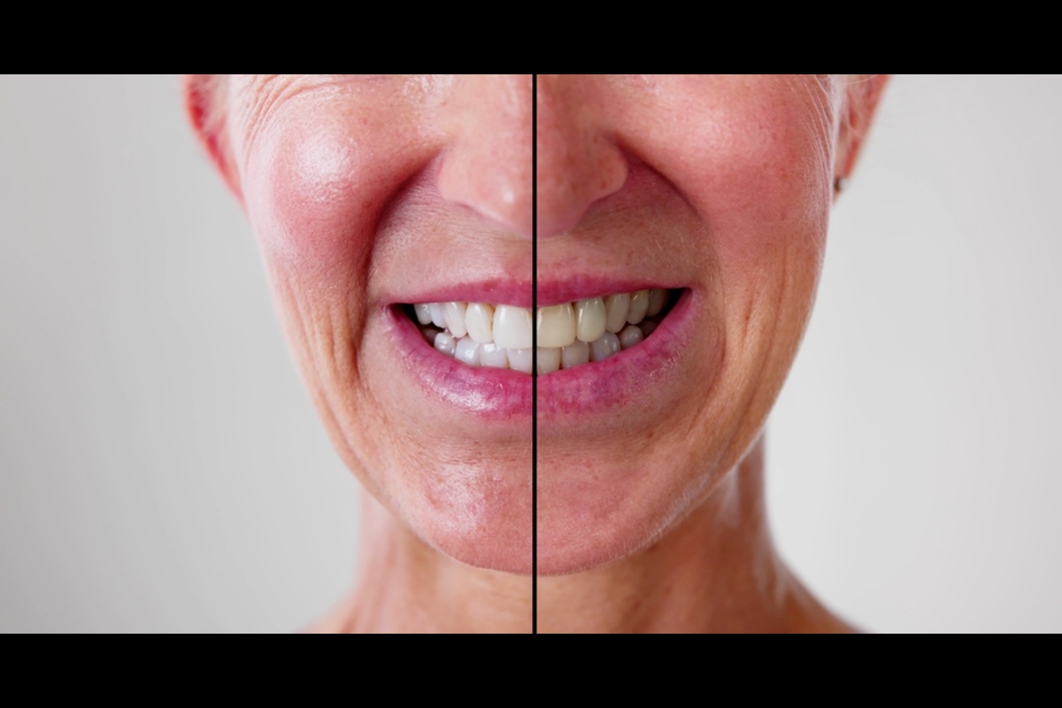 Cosmetic dental treatments including teeth whitening, veneers, and smile makeover for a brighter, confident smile