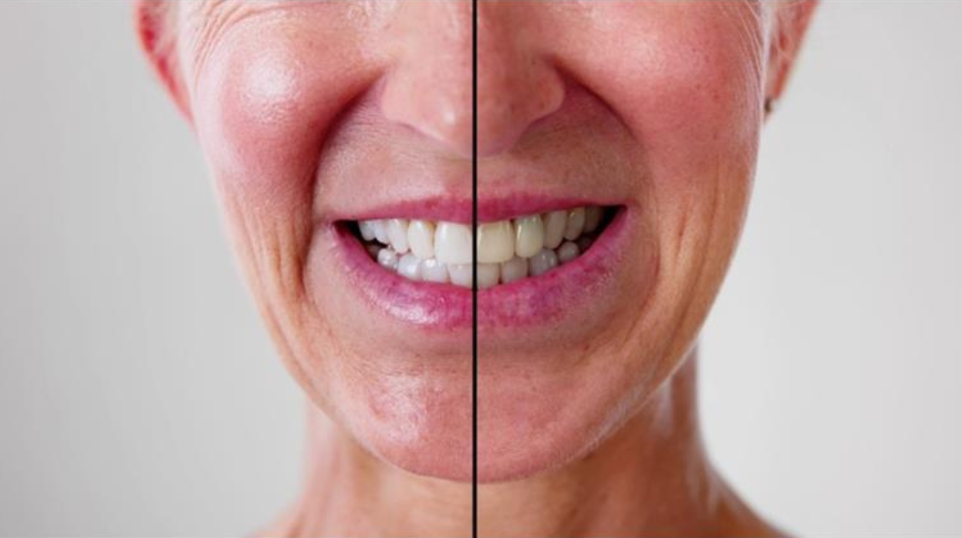 cosmetic dentistry in peterborough