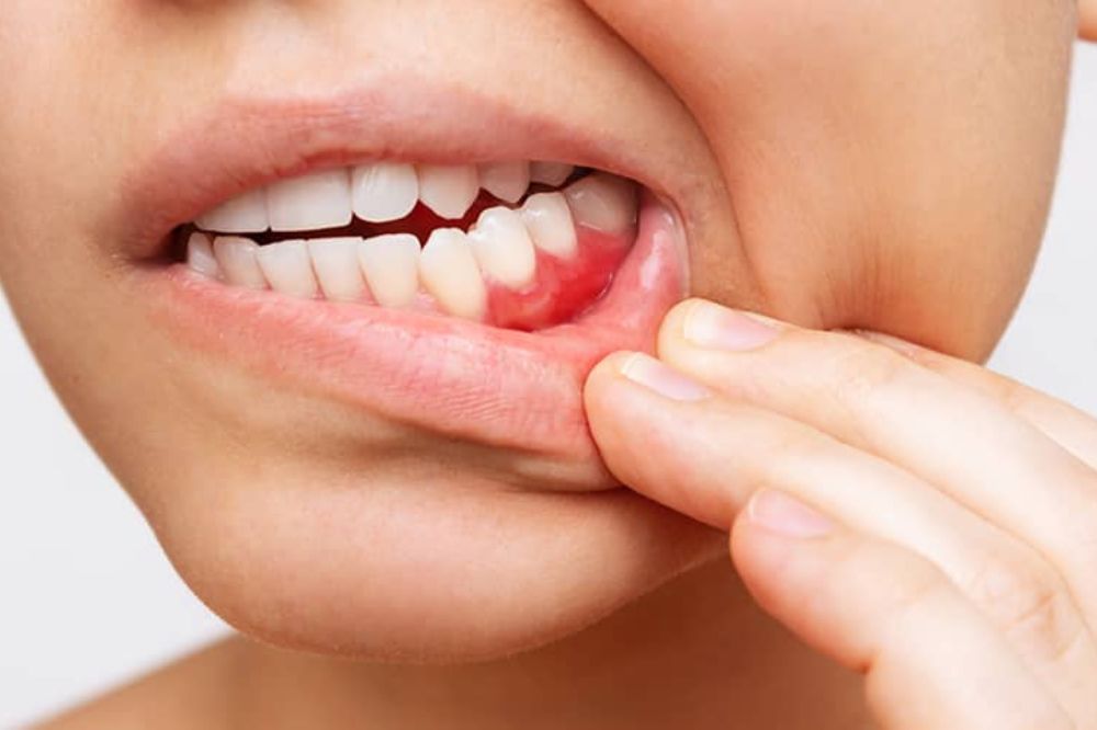 Is Your Gum Health At Risk?